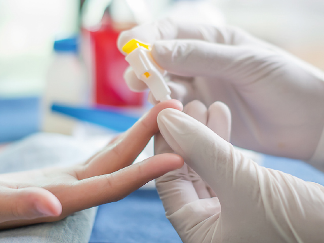 アレルギー採血